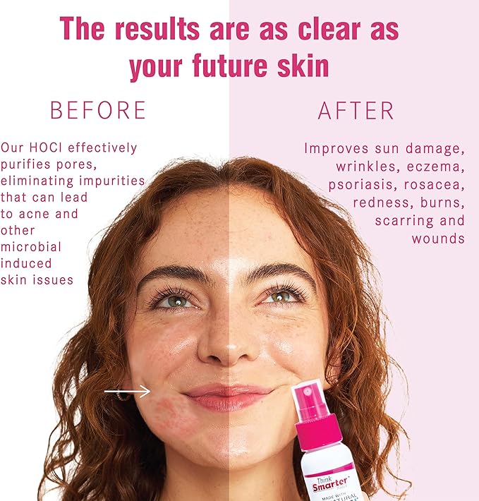 Multi-Use HOCl Spray