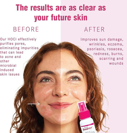 Multi-Use HOCl Spray